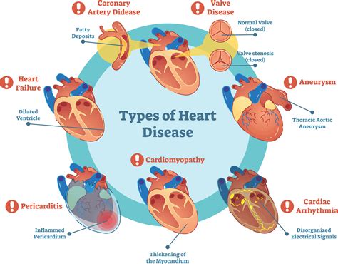 Mental Health And Heart Disease