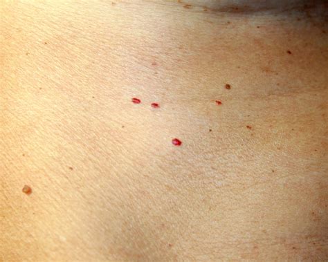 7 Causes of Red Spots and Bumps on Skin, With Pictures | Allure