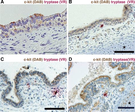 c-Kit expression in central airway epithelial cells. Before 20 GW ...