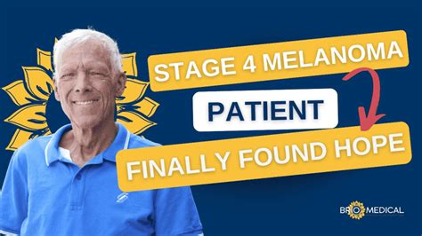 Stage 4 Melanoma Cancer Treatment | Lance's Success Story