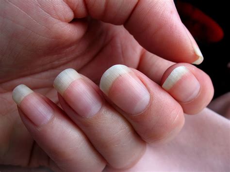 What's Up With That: Your Fingernails Grow Way Faster Than Your Toenails | WIRED