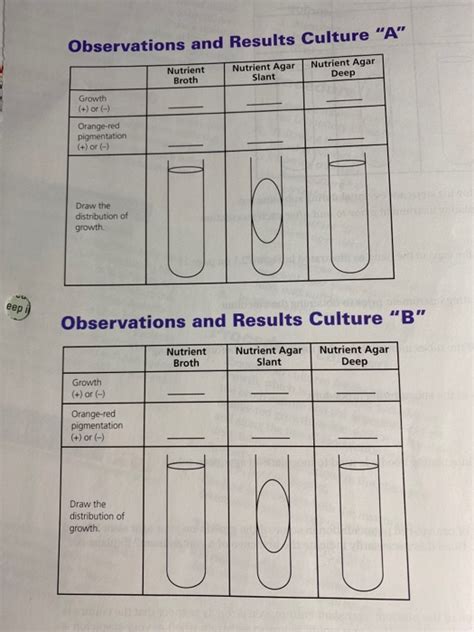 Observations and Results Culture "A" Nutrient Agar | Chegg.com