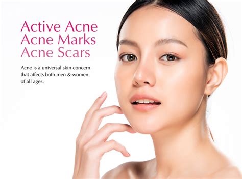 Best Acne Skin Laser Treatment Near Me in Malaysia | DR.D Clinic