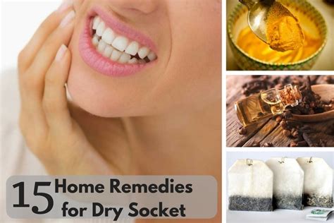 15 Home Remedies for Dry Socket