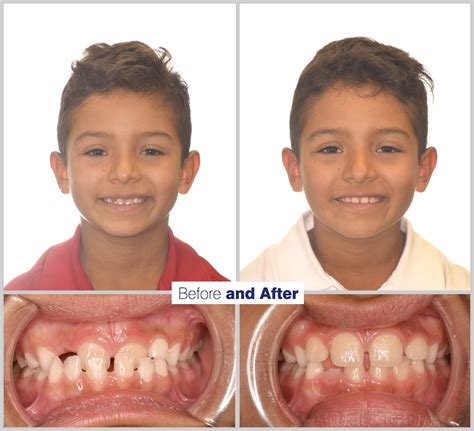 Before and after treatment pictures of our patients.