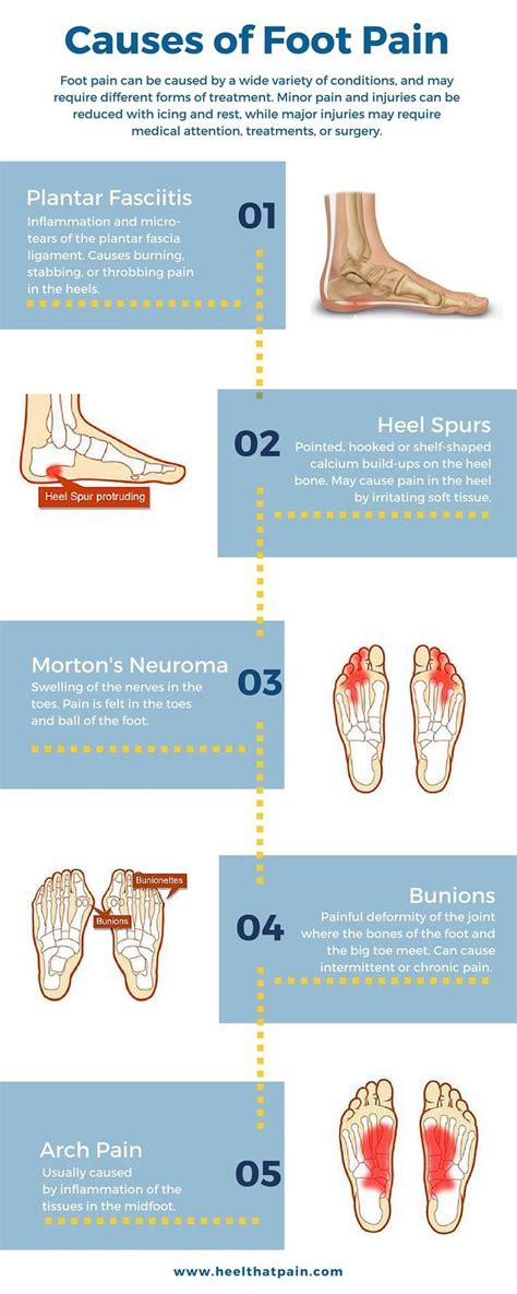 Top Of Foot Pain Diagnosis Chart