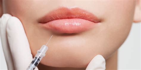 Facial Fillers and Injections Are the Biggest Trends in Plastic Surgery | SELF