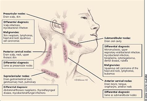 Lymphadenopathy and Malignancy | AAFP