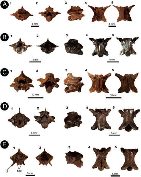 Isolated vertebral remains attributed to Colubroidea. (A) IVIC OR-3667 ...