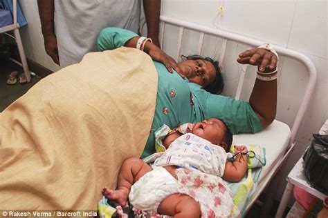 India's biggest baby ever born is a massive 13lb and has obesity risk | Daily Mail Online