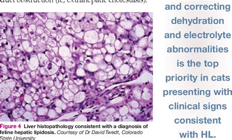 Hepatic Lipidosis Histology