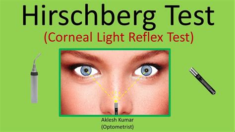 Corneal Light Reflex Abnormal Findings