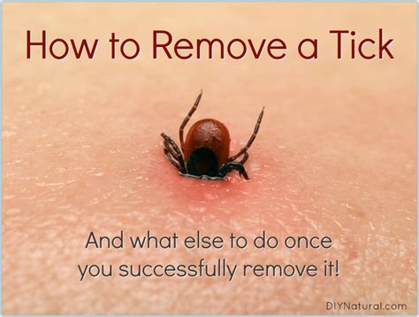 How To Remove A Tick Head - All You Need Infos