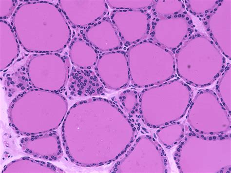 thyroid with folicles Histology Slides, Lab Image, Tissue Types, Adrenal Support, Alphabet Code ...