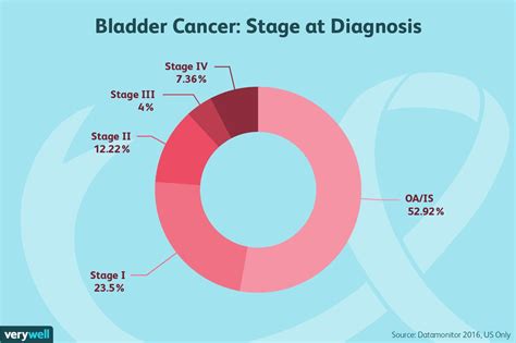 Cancer Stages Chart