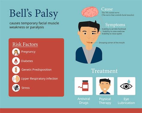 Premium Vector | Bell's palsy infographic to show the cause the symptom