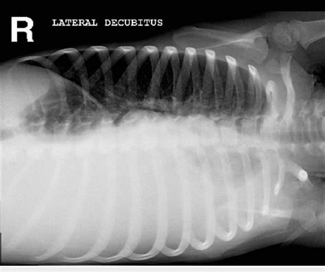 Right Lateral Decubitus Position