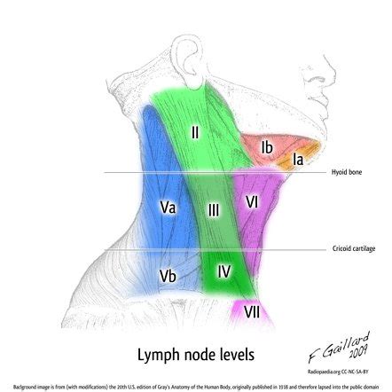 Lymph node levels (illustration) | Radiology Case | Radiopaedia.org