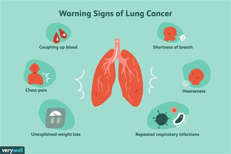 Lung Cancer Symptoms Coughing Up Phlegm - CancerWalls