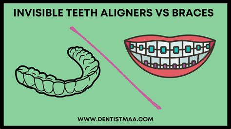 Invisible Teeth Aligners vs Braces - DentistMaa