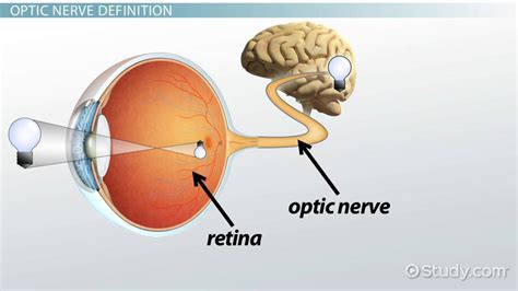 Optic Nerve Damage | Overview, Symptoms & Treatment - Video & Lesson Transcript | Study.com