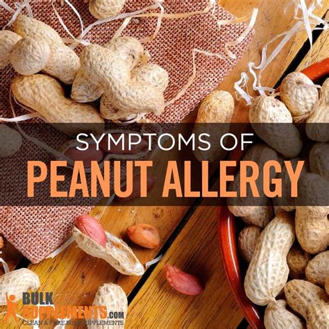 Peanut Allergy: Symptoms, Causes & Treatment