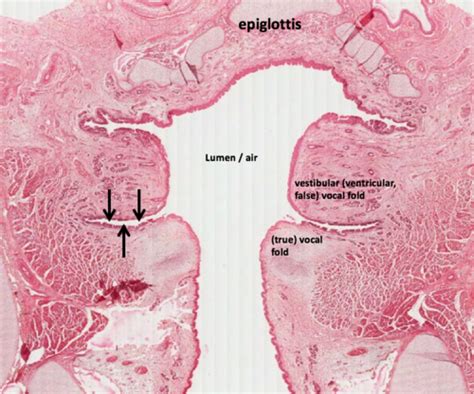 Vocal Folds Histology