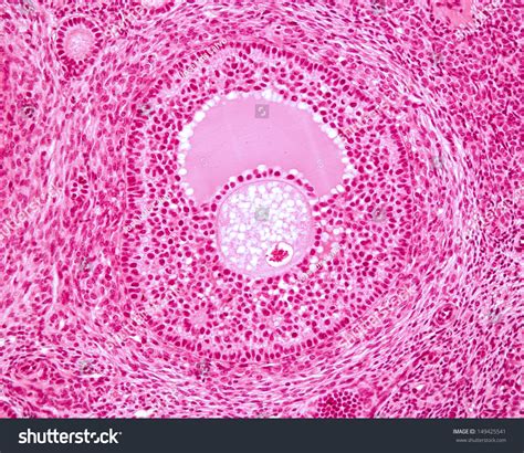 Secondary Follicle Histology