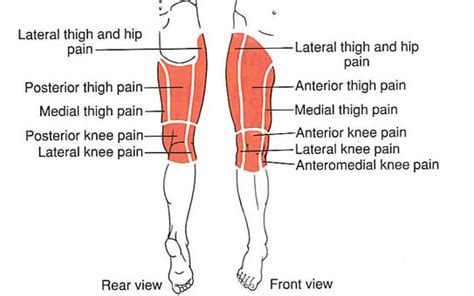 What Causes Sharp and Stabbing Pain in Your Thigh? | Med-Health.net