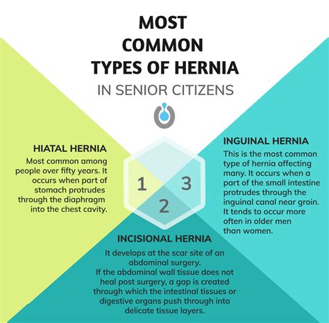 What Is Hernia And Types - Ideas of Europedias