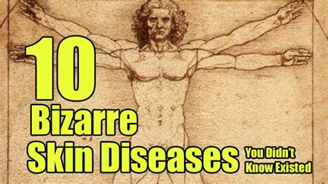 10 Bizarre Skin Diseases You Didn’t Know Existed | Heavy.com | Page 6