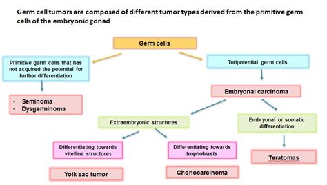 Germ cell tumor – ovary – Histopathology.guru