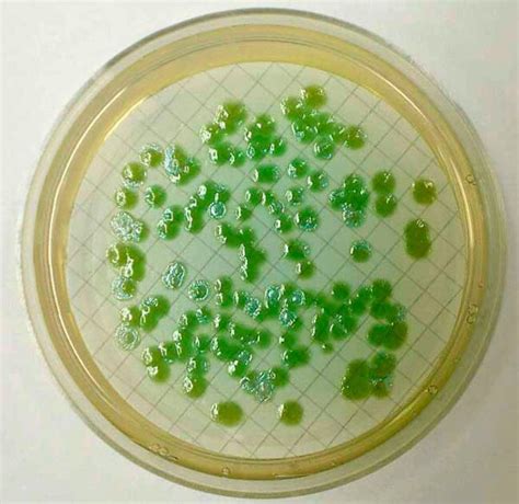 Scharlab Cetrimide Agar (Eur. Pharm.) Cetrimide Agar; Form: Solid | Fisher Scientific