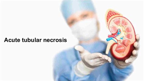 Acute tubular necrosis causes, symptoms, diagnosis & treatment