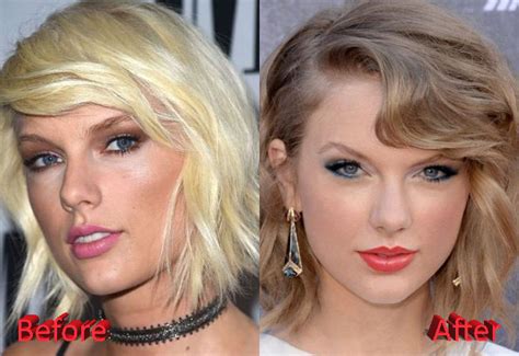 Taylor Swift Plastic Surgery Before and After