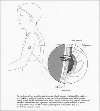 How nicotine patch is made - material, used, processing, components, product, Raw Materials