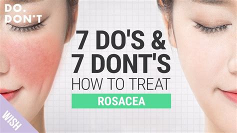 14 Tips for Rosacea That Really Work | Skin care