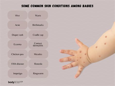 Common Skin Conditions In Babies