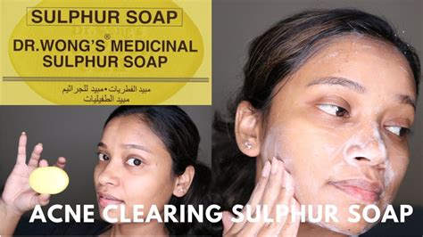 Dr. Wong's Sulphur soap for acne treatment and clear skin - YouTube