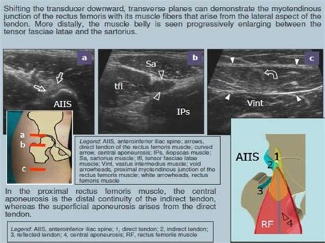 Hip Adductors Ultrasound