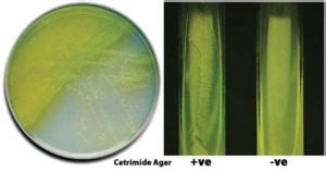 Cetrimide Agar- Composition, Principle, Preparation, Results, Uses