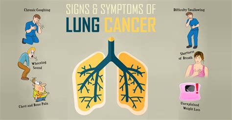 Lung Cancer Symptoms In Young Adults - CancerWalls