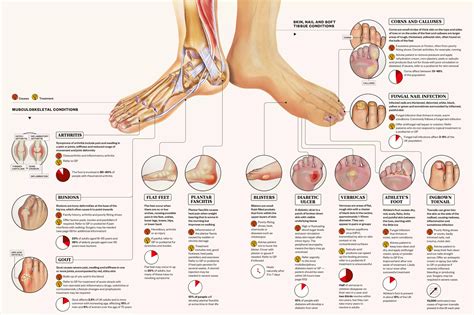 Types Of Foot Pain Diagnosis