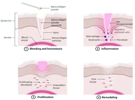 An illustrative image demonstrating a proposed skin wound-healing... | Download Scientific Diagram