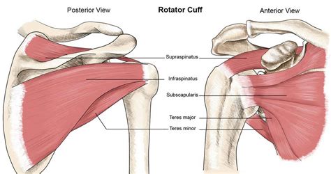 Calcific tendinosis causes, symptoms, diagnosis, treatment & prognosis