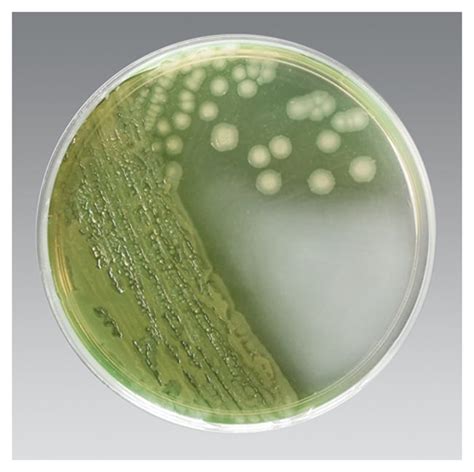 Thermo Scientific Cetrimide Selective Agar:Microbiological Media and Media | Fisher Scientific