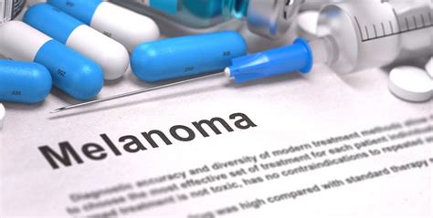 Melanoma Skin Cancer Treatment