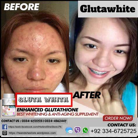 perfect white skin whitening tablets- effective antiaging and whitening product!in pakistan