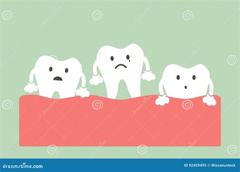 Loose tooth stock vector. Illustration of missing, health - 92459495