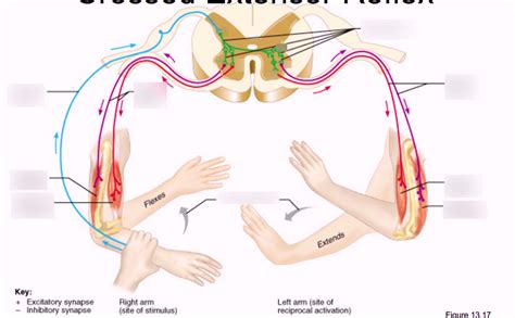 Crossed Extensor Reflex Diagram | Quizlet